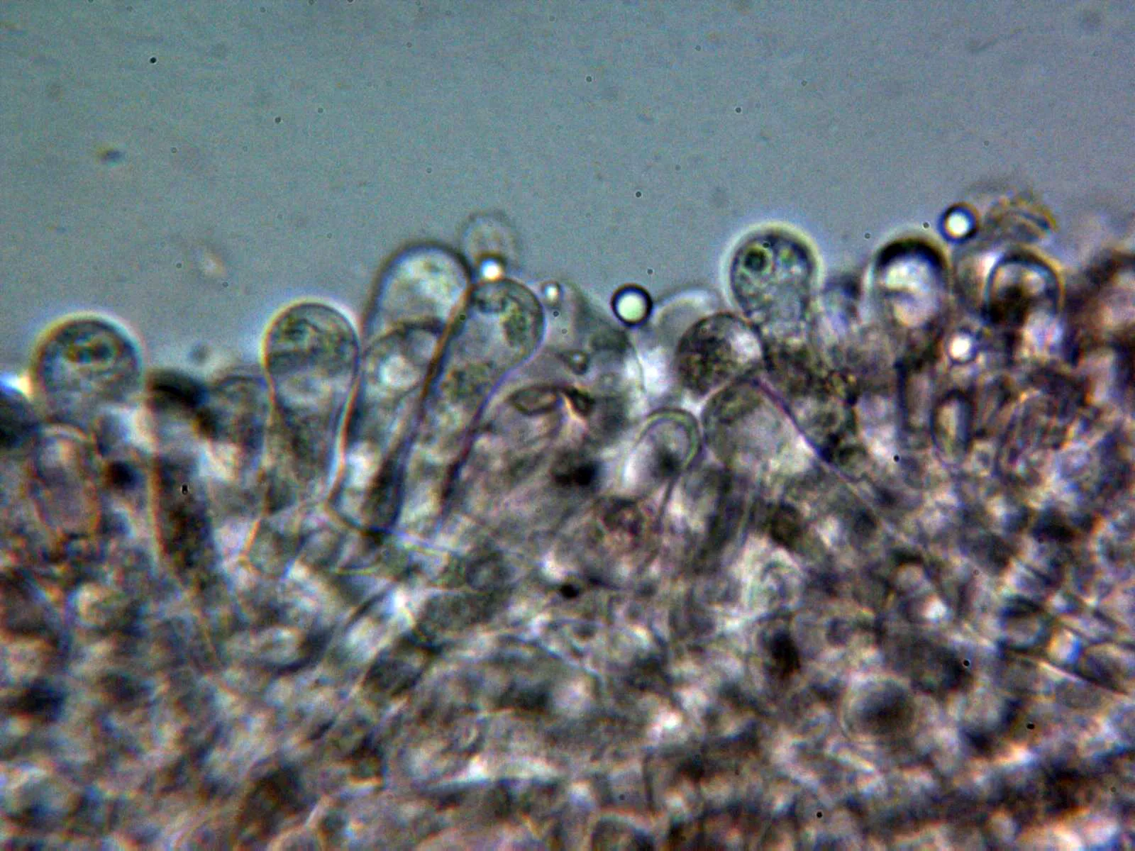 Microscopía de Melanoleuca melaleuca - 10 - Arista laminar 1